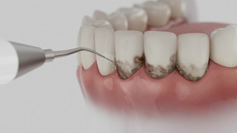Reliable Dental contractor in Union Hall, VA by Dentist Open Now